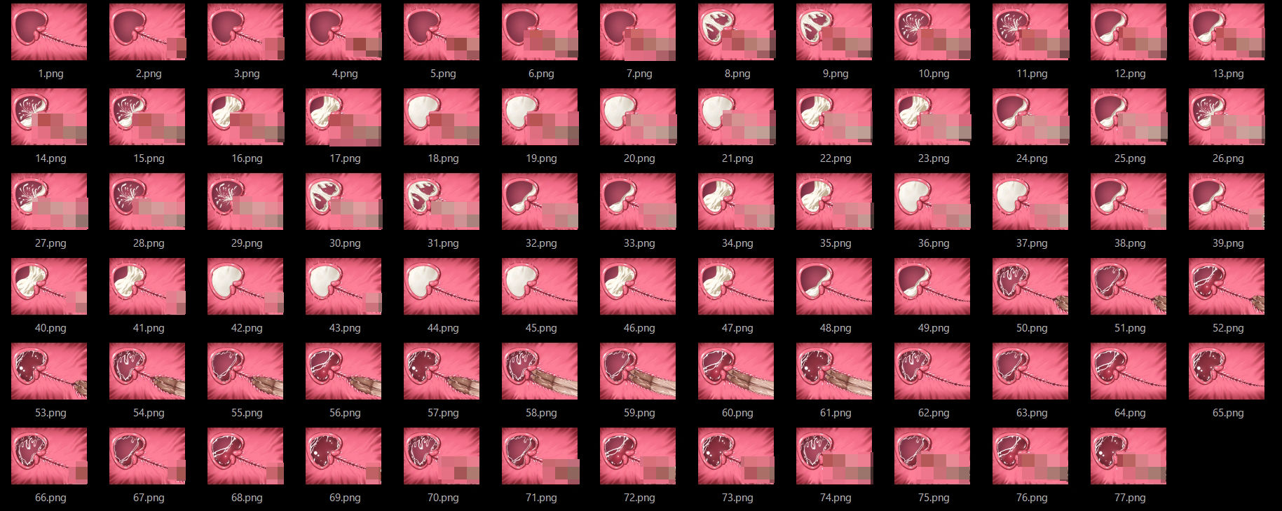 膣内断面図素材2 画像5