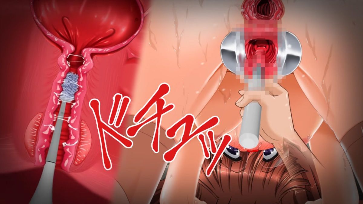 肉奴●志願〜100日間の拡張調教〜アニメーション全集 画像8