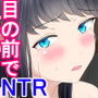 ミテルダケ