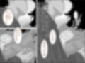 母の本懐 モノクロ版