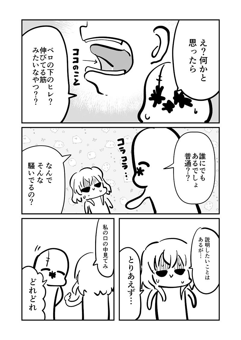 ベロをレーザーで焼いた話1_7