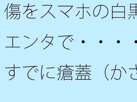 [무료] 상처를 스마트폰의 흑백 엔터테인먼트로 … 이미 딱지가 되어 있다?