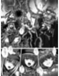 全滅女アドベンチャー