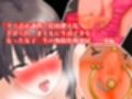 【4話セット】『女子〇生クリトリス調教、陰核を執拗に嬲り回され二度と戻らない肥大化巨クリにされてまともに生活できなくなる美少女』とその後の無限焦燥地獄
