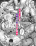 男の子♂だよ！！ 〜ラプンツェル編〜