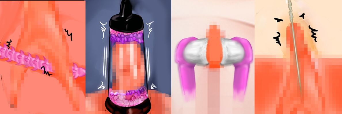 【前後編セット】『清純な女子〇〇〇を監禁し陰核と尿道をグチャグチャに責め抜き、ズル剥け勃起クリトリスと敏感尿道で一生まともに排尿も生活もできなくして人生終了させる』8