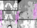 JK戦士バニー・チェリー メス○キヒロイン、オナホールに墜つ。 ザコに市民に無様敗北！尊厳破壊で無限マゾアクメ地獄〜