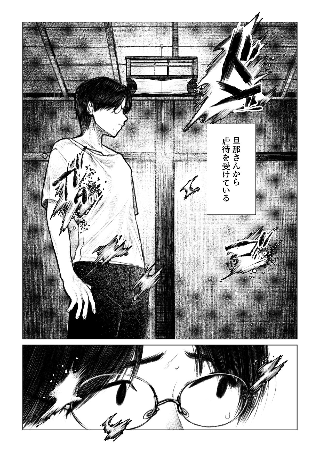 サンプル画像2:痣と痕(その線には色がない) [d_710495]