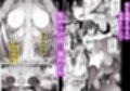 盛りざかり男の娘バージョンセット