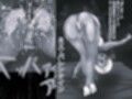 マンピース性欲王ノジコ編 ミスバレンタイン編モノクロ版