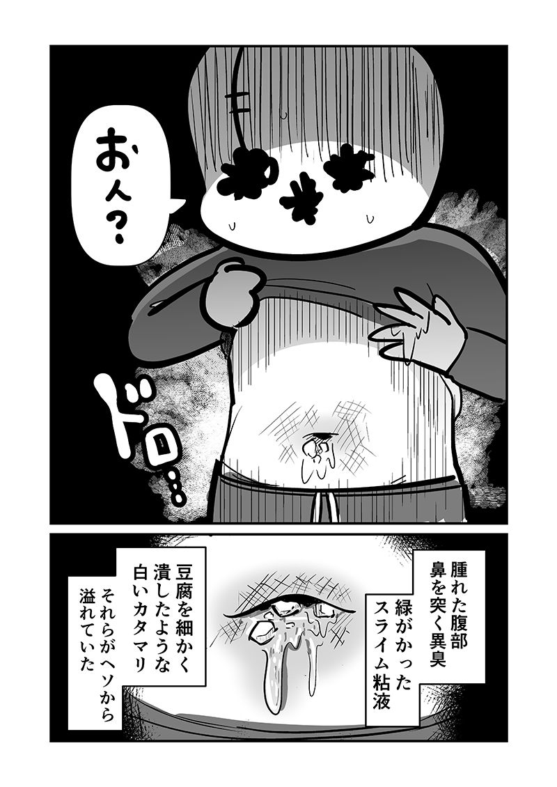 〆切に追われて栄養剤＋仮眠を繰り返していたらおヘソから膿が出て入院した話2 画像4